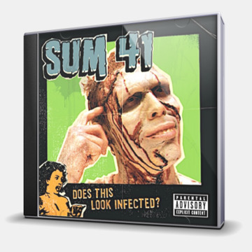DOES THIS LOOK INFECTED?